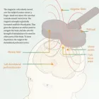 Business 3 image MINDFUL TMS NEUROCARE CENTERS Transcranial Magnetic Stimulation in Brookfield IL