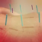 Business 4 image MORNINGSIDE ACUPUNCTURE in New York NY