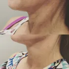 Business 1 image MORPHEUS MEDICAL AESTHETICS Skin Care Clinics in Albany CA