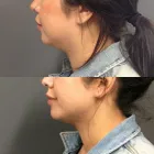 Business 2 image MORPHEUS MEDICAL AESTHETICS Skin Care Clinics in Albany CA