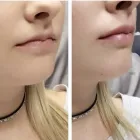 Business 3 image MORPHEUS MEDICAL AESTHETICS Skin Care Clinics in Albany CA