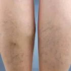 Business 2 image NORTH TEXAS VEIN CLINIC in Fort Worth TX