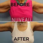 Business 3 image NUVEAU PLASTIC SURGERY & MEDICAL AESTHETICS Plastic & Cosmetic Surgery in Houston TX