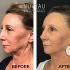 Business 5 image NUVEAU PLASTIC SURGERY & MEDICAL AESTHETICS Plastic & Cosmetic Surgery in Houston TX
