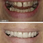 Business 5 image NYC DENTAL IMPLANTS CENTER Cosmetic Dentist in New York NY