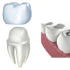 Business 5 image OF DENTAL CARE - WEST HOLLYWOOD Teeth Whitening Service in West Hollywood CA