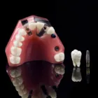Business 6 image OF DENTAL CARE - WEST HOLLYWOOD Teeth Whitening Service in West Hollywood CA