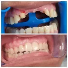 Business 1 image OPAL DENTAL Root Canal in Mesquite TX