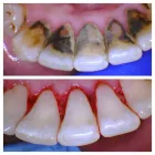 Business 2 image OPAL DENTAL Root Canal in Mesquite TX