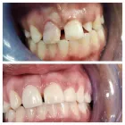 Business 3 image OPAL DENTAL Root Canal in Mesquite TX