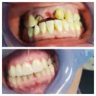 Business 4 image OPAL DENTAL Root Canal in Mesquite TX