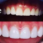 Business 1 image ORANGE PARK SMILE STUDIO Veneer in Orange CA