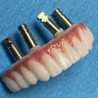 Business 2 image ORLANDO LIFESTYLE DENTISTRY Dental Implants in Winter Park FL