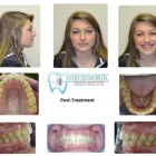 Business 7 image ORTHODONTIST IN COLORADO SPRINGS Orthodontists in Colorado Springs CO