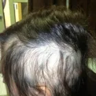 Business 3 image PARKER TRICHOLOGY CENTRE Scalp Treatment in Carrollton TX