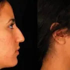 Business 1 image PETER B FODOR MD, FACS Tummy Tuck in Los Angeles CA
