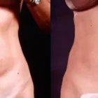 Business 6 image PETER B FODOR MD, FACS Tummy Tuck in Los Angeles CA