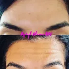 Business 1 image PHRESH SKIN AESTHETIC CONCIERGE SERVICES LLC Vitamin Drip in Walnut Creek CA