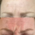 Business 5 image PHRESH SKIN AESTHETIC CONCIERGE SERVICES LLC Vitamin Drip in Walnut Creek CA