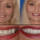 Business 2 image PLANO SMILE STUDIO Dentists in Plano TX