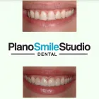Business 3 image PLANO SMILE STUDIO Dentists in Plano TX
