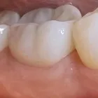 Business 4 image PLANO SMILE STUDIO Dentists in Plano TX