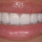 Business 6 image PLANO SMILE STUDIO Dentists in Plano TX