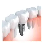 Business 7 image PLANO SMILE STUDIO Dentists in Plano TX