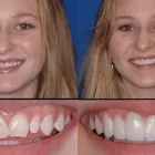 Business 8 image PLANO SMILE STUDIO Dentists in Plano TX