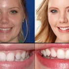 Business 9 image PLANO SMILE STUDIO Dentists in Plano TX