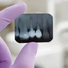 Business 2 image PORCELAIN VENEERS TEETH in Brooklyn NY