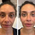 Business 3 image POSH AESTHETICS & WELLNESS in Staten Island NY