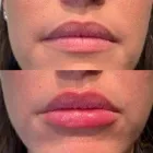 Business 4 image POSH AESTHETICS & WELLNESS in Staten Island NY
