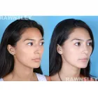 Business 1 image RAWNSLEY PLASTIC SURGERY Plastic Surgery Clinic in Los Angeles CA
