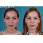 Business 2 image RAWNSLEY PLASTIC SURGERY Plastic Surgery Clinic in Los Angeles CA