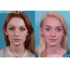 Business 3 image RAWNSLEY PLASTIC SURGERY Plastic Surgery Clinic in Los Angeles CA