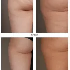 Business 6 image REDOX HEALTH REVOLUTION in Renton WA