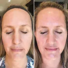 Business 1 image REVIVED AESTHETICS Mobile Facials in Tustin CA