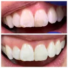 Business 6 image RICKOFF DENTISTRY Cosmetic Dentist in Noblesville IN