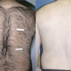 Business 5 image SAXON MD FACIAL PLASTIC SURGERY Hair Removal in Austin TX