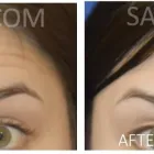 Business 6 image SAXON MD FACIAL PLASTIC SURGERY Hair Removal in Austin TX