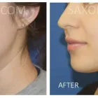 Business 7 image SAXON MD FACIAL PLASTIC SURGERY Hair Removal in Austin TX