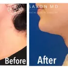 Business 8 image SAXON MD FACIAL PLASTIC SURGERY Hair Removal in Austin TX