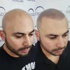 Business 5 image SCALP CO. SCALP MICRO PIGMENTATION Tattoo Parlor in Sacramento CA