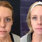 Business 2 image SCULPTED MED SPA & CRYOTHERAPY CENTER Juvederm in Oklahoma City OK