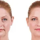 Business 4 image SCULPTED MED SPA & CRYOTHERAPY CENTER Juvederm in Oklahoma City OK