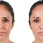 Business 6 image SCULPTED MED SPA & CRYOTHERAPY CENTER Juvederm in Oklahoma City OK