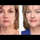 Business 5 image SOUSAN MED SPA in Houston TX