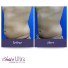 Business 36 image SOUSAN MED SPA in Houston TX