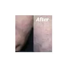 Business 13 image ST LOUIS LASER VEIN CENTER in St. Louis MO